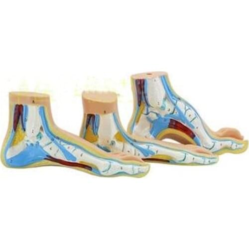 PVC Material Normal Foot Flat Foot Arched Foot Model Foot Pathology Model Human Foot Muscle Anatomy Model