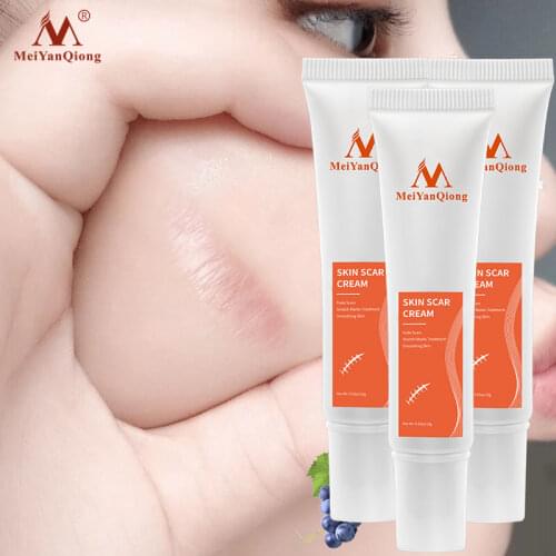 3pcs/lot Facial repair removes facial scar hyperpigmentation blackhead whitening skin anti-wrinkle anti-aging moisturizing