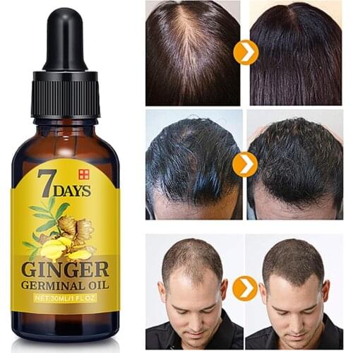30ML Effective Hair Loss Treatement Conditioners Natural Ginger Plant Serum Essence Oil Fast Growth Hair Repair Care Cosmetic