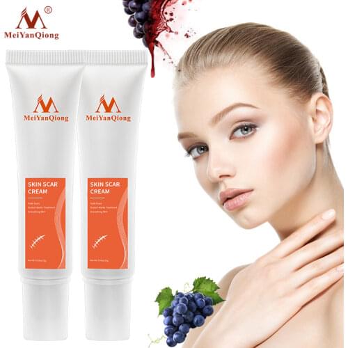 2pcs/lot Face Herbal Extract Against Black Dots Cream Scar Removal Facial Blackhead Acne Skin Care Treatment Bleaching Cream