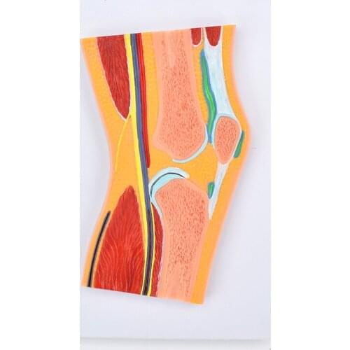 CMAM/12714 , Knee Joint Section,Medical Extremities Anatomical Human Model
