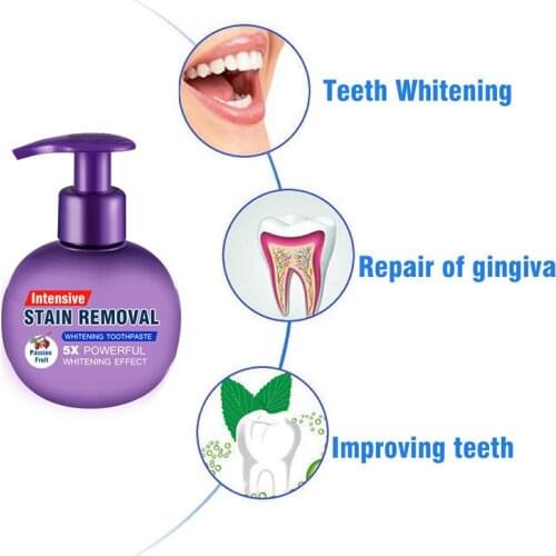 Magical Soda Whitening Toothpaste Teeth Whitening Cleaning Hygiene Oral Care Passion Fruit Fight Bleeding Gums More Option