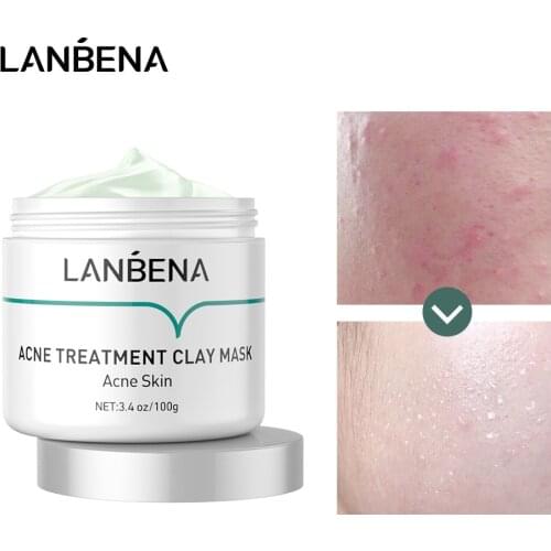LANBENA Acne Treatment Washable Clay Mask Deep Cleansing Acne Care Remove Chronic Grease Firming Pores Oil Control Shrink Pores