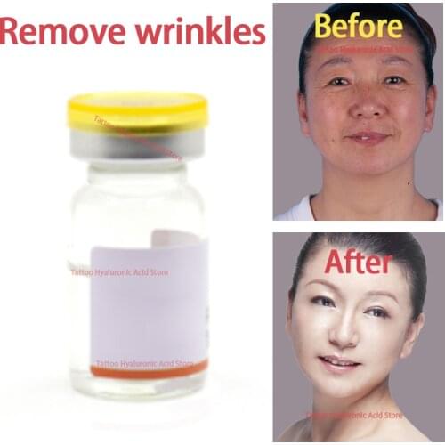 5ml wrinkle removal essence
