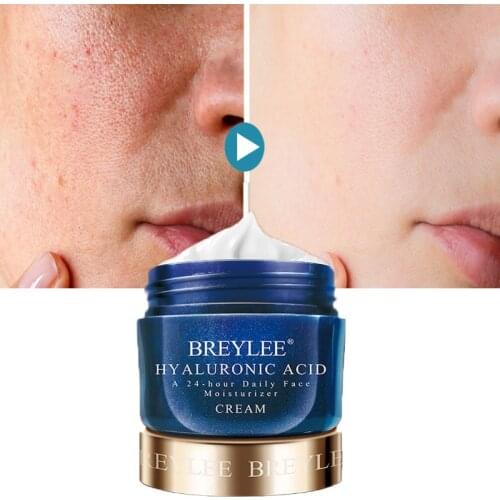 BREYLEE Face Cream Hyaluronic Acid Remove Dark Spots Anti-Aging Shrink Pore Whitening Moisturizing Facial Cream Brighten Skin