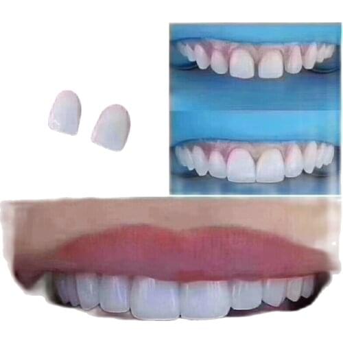 3Pcs No.22# Dental Veneers Whitening Ceramic Bright White LMS