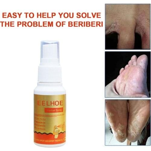 30ml Anti Fungal Infections Foot Spray Athletes Foot Feet Care Spray For Beriberi Itch Erosion Peeling Blisters Anti Bacterial