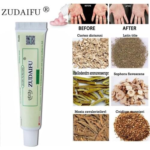 Zudaifu Cream Psoriasis Body Skin Care Cream Dermatitis Eczematoid Eczema Ointment Treatment