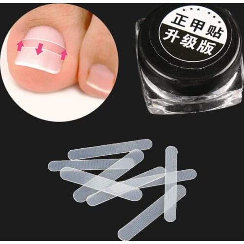 10pcs Ingrown Toenail Correction Tool Ingrown Toe Nail Treatment Elastic Patch Sticker Straightening Clip Brace Pedicure Tool