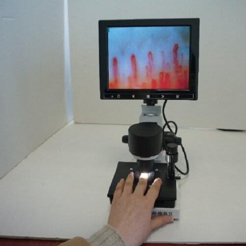 8 Inch Nailfold Capillaroscopy Capilar Health Care Diagnosis Hyperthyroidism Microcirculation of Nail Wall Observer Clinic Use