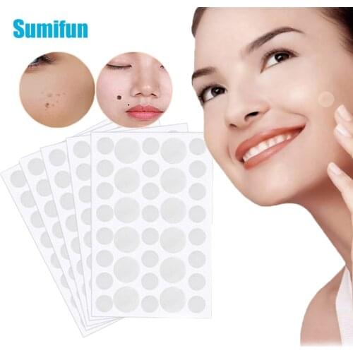 108pcs=3Pack Acne Patch Warts Remover Patches Foot Sticker Corn Skin Tag Removal Patches Wart Treatment Cream Skin Care D2668