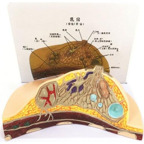 Medical Science Female Pathology Breast Model