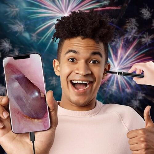 5.5MM Ear Cleaning Scope Endoscope USB Earpick Wax Camera Medical Veterinary Otoscope Video HD 720P Android Otoscopio Digital