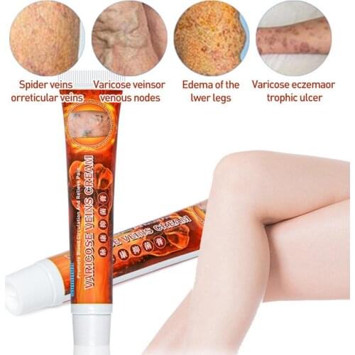 Chinese Herbal Medicine Natural Anti Bacteria Cream Treatment 20g Eczema Psoriasis Ointment F6J9