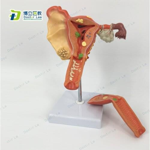 Pathological model of the female genital organs medical condoms skeleton trauma anatomy traumatism instruments traumatic gun buy