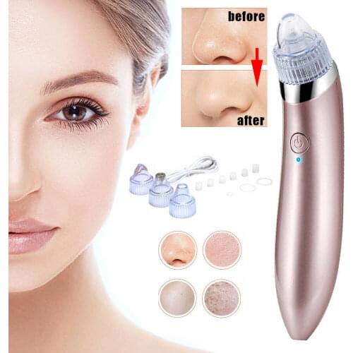 Black Dots Vacuum Pore Cleaner Nose Black Point Remover Blackhead Acne Pimple Removal Suction Extractor Facial Beauty Care Tools