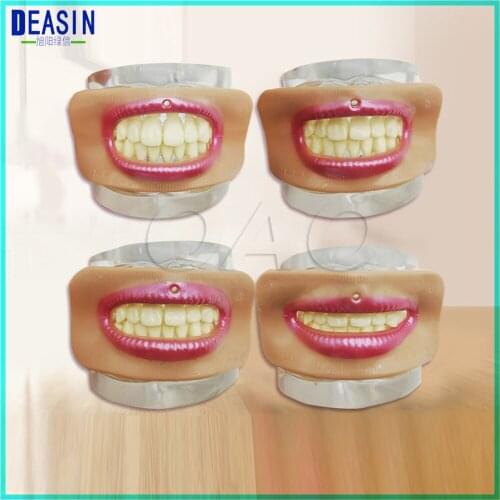 Dental Tooth Alignment Check Mouth Measuring Lip Measurement Tool Aesthetics Meaurement Parts Accessories Different 4 pcs/ set