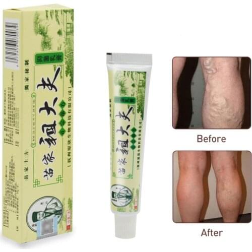 Skin Psoriasis Cream Dermatitis Eczematoid Eczema Ointment Skin Care Cream Psoriasis Skin Care Cream
