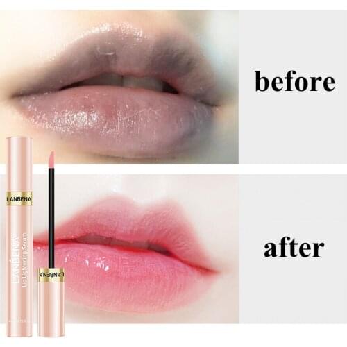 Fruit Lip Gloss Moisturizing Removing Melanin Lip Brighten Serum Arbutin Reduce Lip Pigmentation Ben Oil Antioxidation Lip Balm