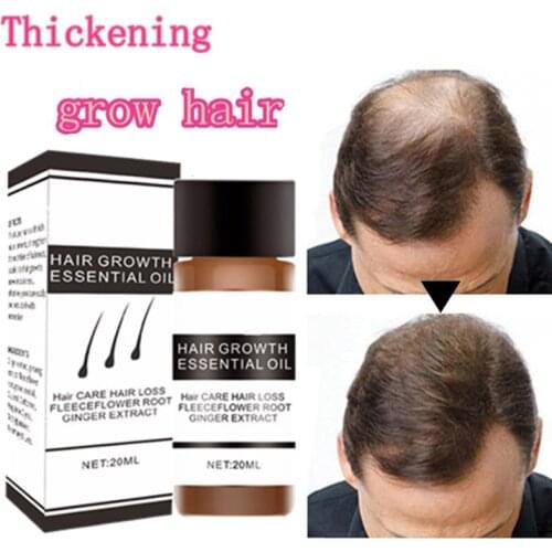 20ml Fast Hair Growth oil Essence serum ginger shampoo for Women man anti Hair Loss treatment Hair Repair Growing Repair Coarse