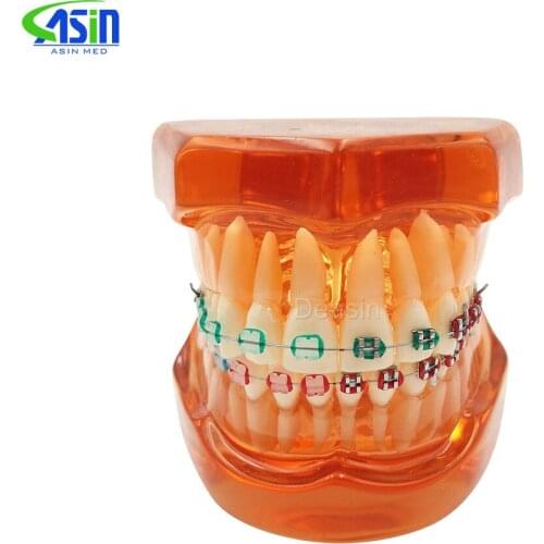 Teeth model With metal & ceramic brackets Irregular tooth Ortho Metal dentist patient student learning model