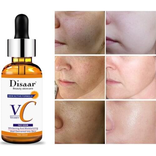 30ML Vitamin C Liquid Serum Anti-aging Whitening VC Essence Oil Topical Facial Serum with Hyaluronic Acid & Vitamin E Retinol