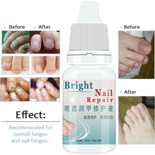 10ml Anti-fungal Cuticle Oil Nail Repair Treatment Growth Fungi Oil Strengthen Nai Toenail Mint Manicure Fungus Nail Bright B7C9