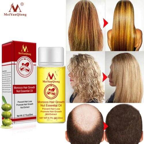 MeiYanQiong Fast Powerful Hair Growth Essence Hair Loss Products Essential Oil Treatment Preventing Hair Loss Hair Care Products