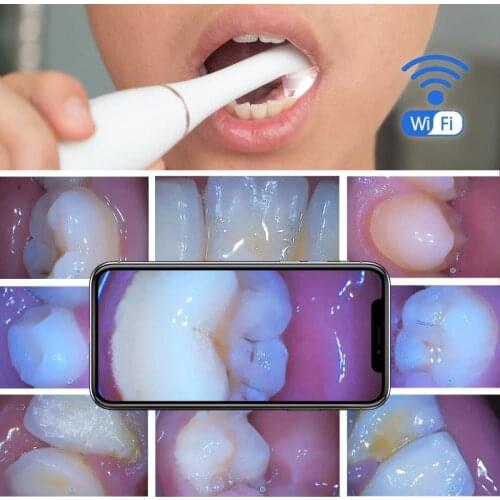 Wireless WiFi Oral Dental Camera HD Intraoral Endoscope Adjustable For Dentist Diagnostic Tool with Light