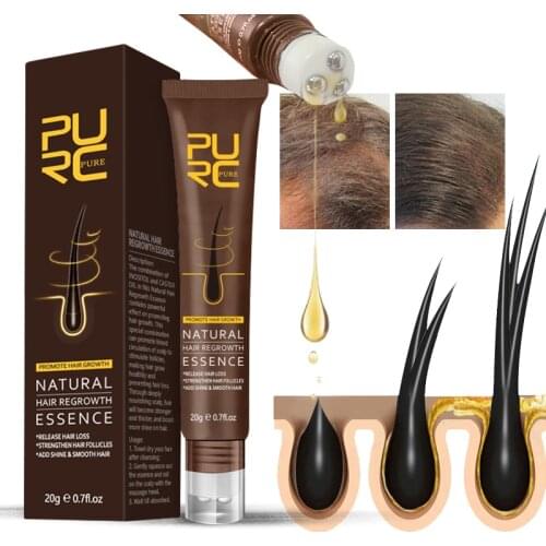 PURC Fast Hair Growth Oil Prevent Hair Loss Treatment Ginger Extract Growing Hair Products for Hair Care and Scalp