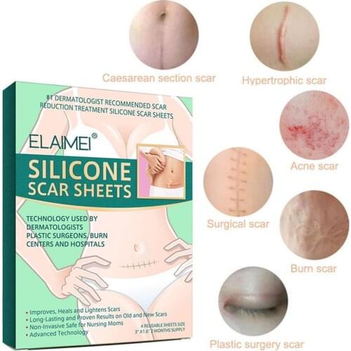 Reusable Silicone Scar Sheets Removal Patch Acne Gel Remove Trauma Therapy Silicon Scar Sheet Repair Burn Skin Patch C4N3
