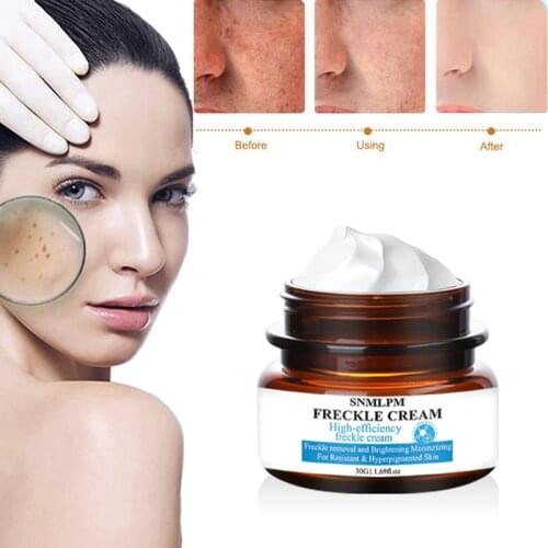 SNMLPM Whitening Freckle Cream Chinese Herbal Plant Face Cream Remove Freckles Dark Spots Skin Moisturize Cream Face Care TSLM2