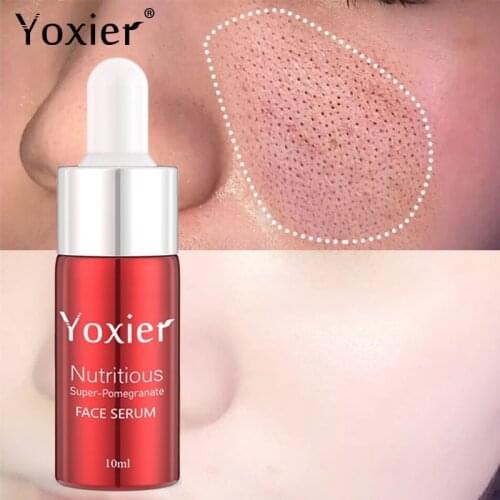 Yoxier Face whitening Serum Moisturizing Shrink Pore Nourish Brighten Pomegranate Nicotinamide Skin Care Pigmentation Corrector