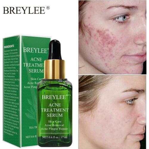 ALIVER Whitening Face Serum