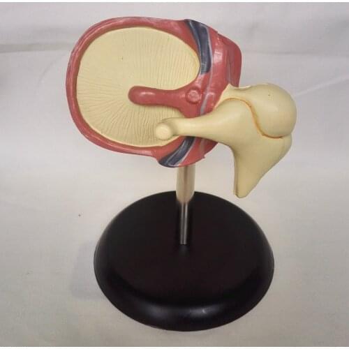 Human Cochlea Enlarge Model Cochlear Anatomy The Inner Ear Labyrinth Model Medical Teaching Model Medical Organs Teaching Supply