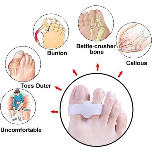 5Pairs Silicone-Hammer Toe Straightener-Separator-Thumb-Hallux Valgus-Foot Care-Pedicure-Protector-Orthopedic-Bunion Corrector