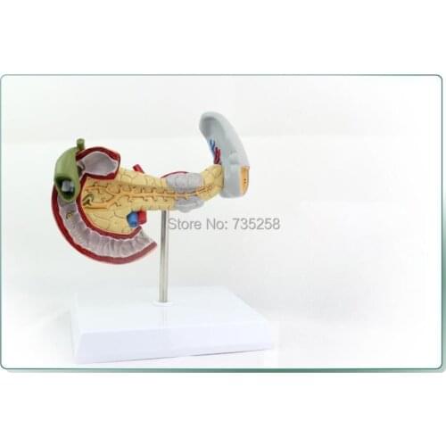 Pancreas, Spleen And Duodenum Lesion Model,Duodenal Pathology Model,Gallbladder Pathologic Model