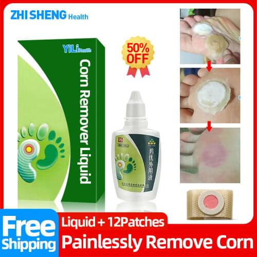 Hand Corn Removal Liquid Wart Remover For Feet Warts Mole Chinese Herbal Cream Papillomas Mole Skin Tag Remover Patch