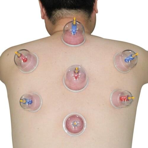 Medical care 12 medical vacuum cupping therapy kits physical health Chinas traditional acupoint cupping therapy