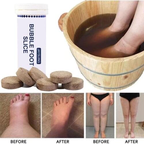 6pcs Anti-Swelling Foot SPA Ginger Foot Soak Effervescent Tablets Treatment Fungal Nail Treatment Detox Foot Skin Cracking Care