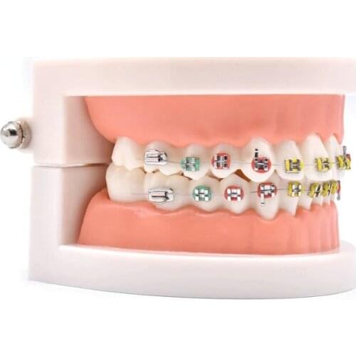 Dental Teach Study Standard Typodont Demonstration Teeth Model With Bracket 1 Pc