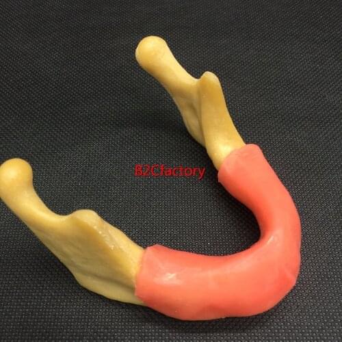 Mandible With Soft Tissue for Dental Implant Model Training Tool