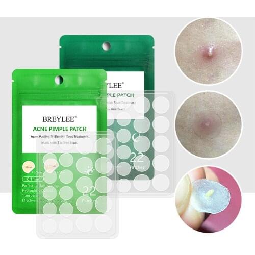 1 Bag Acne Pimple Patch Acne Treatment Stickers Pimple Remover Tool Blemish Spot Skin Care Face Mask Acne Cream Daily Use