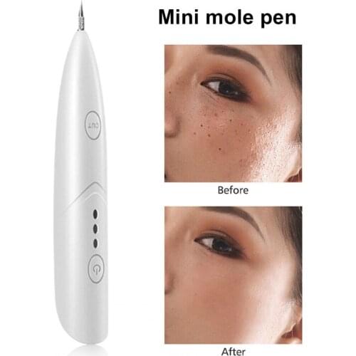 1 Set Skin Tag Remover Laser Plasma Multi-functional Portable Dark Spot Remover Tool Pen Beauty Equipment