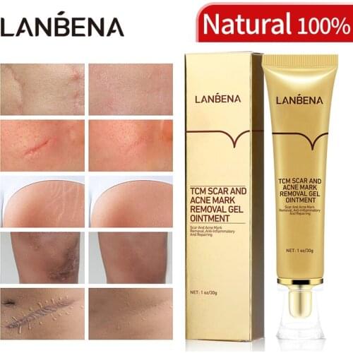 LANBENA Acne Scar Removal Face Cream Acne Spots Acne Pigmentation Corrector Anti Scar Stretch Marks Repair Skin Care 30G