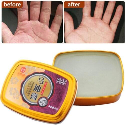 Snake Oil Hand Care Cream Horse Ointment Anti Dry Hand Care Anti Chap Whiten Moisturizing Nourishing Antibacterial Tender