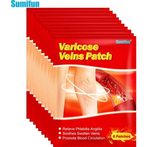 Sumifun 60Pcs/10bags Varicose Veins Treatment Blood Vessel Swelling Spider Leg Vasculitis Phlebitis Care Angiitis Plaster Patch