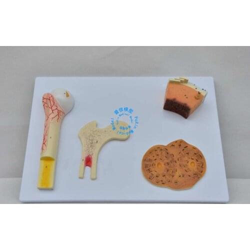 Free shipping&Bone structure model,Cancellous bone,compact bone and femur bone Haversian system model ,medical anatomy