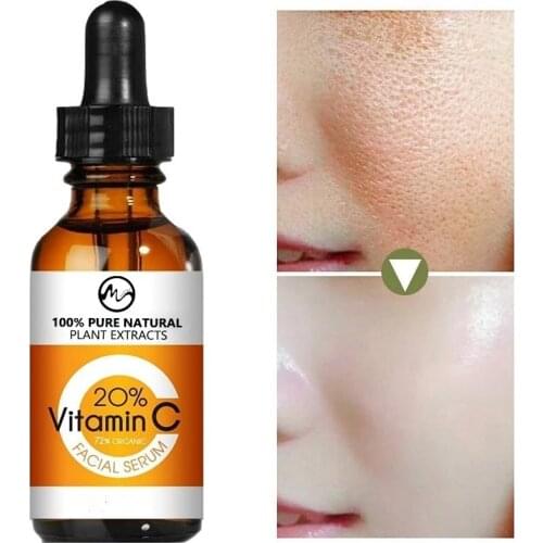 Minch Dark Spot Corrector Vitamin C Whitening Serum Face Essence Freckle Remover Brightening Skin Serum Anti-age Korea Face Care