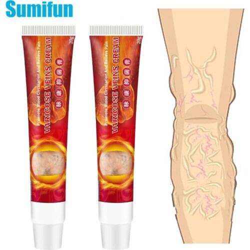 3pcs Varicose Veins Miracle Cream Varicosity Angiitis Remedy Ointment Relief Veins Pain Phlebitis Spider legs Health Care D3175